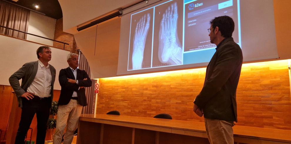 Salud Digital lanza un plan piloto para el uso de la IA en radiografía de Urgencias en Teruel